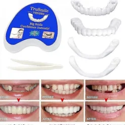Smile Snap On Falske Tænder Øvre Nedre Dental Veneers Gebis Tanddæksel Sæt PTW